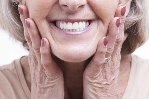 Why All-on-X Implants Are Worth Celebrating
