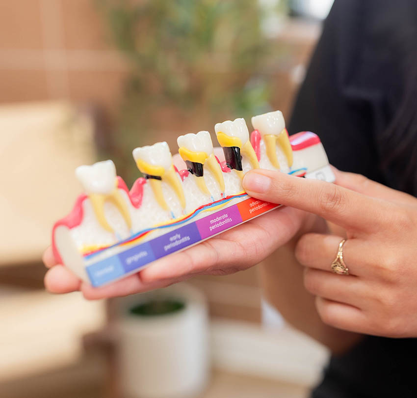 Eat, Laugh, Live Again With All-on-X Dental Implants in El Paso